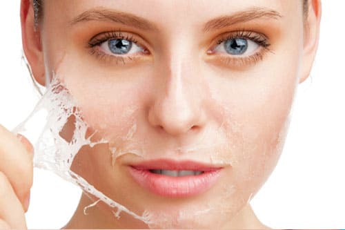 Glycolic Peels