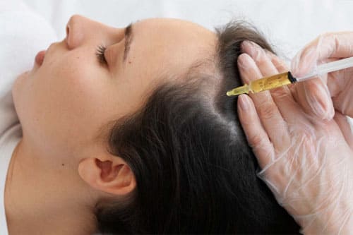 PRP Hair Growth